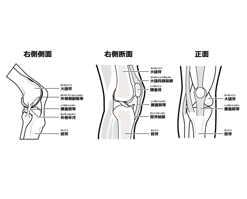 膝蓋大腿関節症のイラスト説明